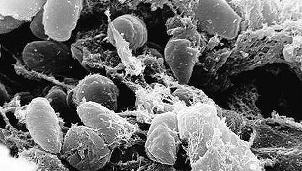 Pandemic watch: What about the plague?
